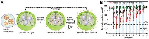 Figure 8 (A) A schematic diagram of the integration of a chitosan microgel with insulin-loaded PLGA nanocapsules. (B) The blood glucose levels in STZ-induced diabetic mice following different conditions: 1) a subcutaneous injection of microgel with FUS treatment (950 kHz; 20 μs; 30 s) (red line); 2) a subcutaneous injection of microgel without FUS treatment (black line); 3) an injection of PBS solution with FUS treatment (green line) (n = 5). Reproduced by permission from Springer Nature. Di J, Yu J, Wang Q et al Ultrasound-triggered noninvasive regulation of blood glucose levels using microgels integrated with insulin nanocapsules. Nano Research. 2017;10(4): 1393–1402. Copyright 2017.Citation129