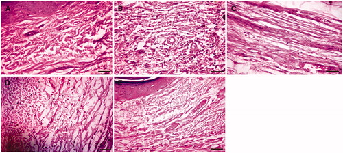 Figure 4. Photomicrograph of left hind paw tissue section stained by H & E. (A) Photomicrograph of paw tissue section from normal control rat. (B) Photomicrograph of paw tissue section from carrageenan control rat. (C) Photomicrograph of paw tissue section from indomethacin (10 mg/kg) treated rat. (D) Photomicrograph of paw tissue section from CAME (100 mg/kg) treated rat. (E) Photomicrograph of paw tissue section from CAME (200 mg/kg) treated rat (magnification: 400×; scale bar: 20 µm).