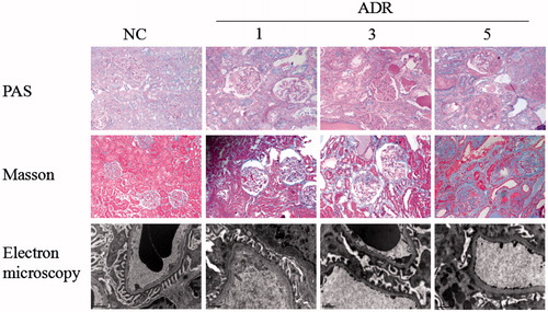 Figure 1. Glomerular pathology and podocyte integrity of control and ADR mice. PAS staining (upper panels) and Masson staining (middle panels) showed ADR mice developed glomerular and interstitial fibrosis. Original magnification, ×200. Electron microscopy (lower panels) indicated that the podocyte foot processes lost their normal interdigitating pattern and showed effacement instead in ADR mice (TEM × 13500).