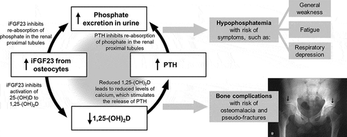Figure 4. Biochemical basis for hypophosphatemia and associated clinical consequences [Citation28,Citation48,Citation49,Citation57–67]