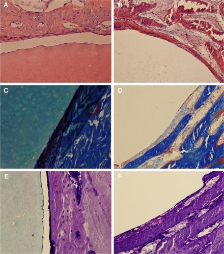 Figure 7 The HE, Masson, and toluidine blue staining.Notes: (A, C, E) in the experimental group and (B, D, F) control group at 12 weeks postoperative (×200).Abbreviation: HE, hematoxylin and eosin.