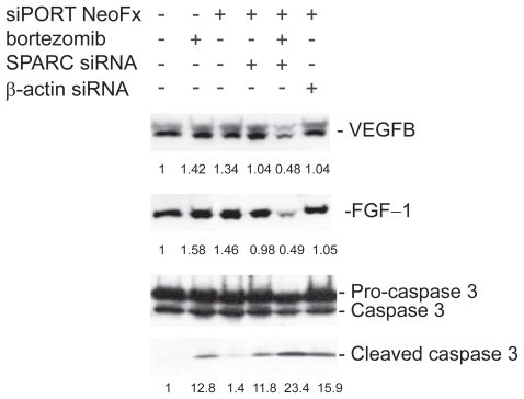 Figure 8 Inhibition of VEGF-B and FGF-1 expression in bortezomib and siRNA treated TaY cells. In the presence of bortezomib, inhibition of SPARC gene expression remarkably suppresses either VEGF-B or FGF-1 expression. In contrast, SPARC siRNA enhanced the cleavage of caspase 3 in the presence of bortezomib, indicating that SPARC siRNA enhanced bortezomib-induced apoptosis in TaY cells.