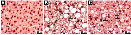 Figure 2 Representative images of histological slides of liver tissue ((A) Control rats, (B) Rats on high-calorie diet for 12 weeks and (C) Rats treated with L-tryptophan (80 mg/kg) in addition to high-calorie diet, Van Gieson stain, x800). 1 – mononuclear hepatocyte; 2 – binuclear hepatocyte; 3 – connective tissue cell; 4 – sinusoids; 5 – hepatocyte with numerous intracellular lipid drops; 6 – lipid drop S > 100 μm2.