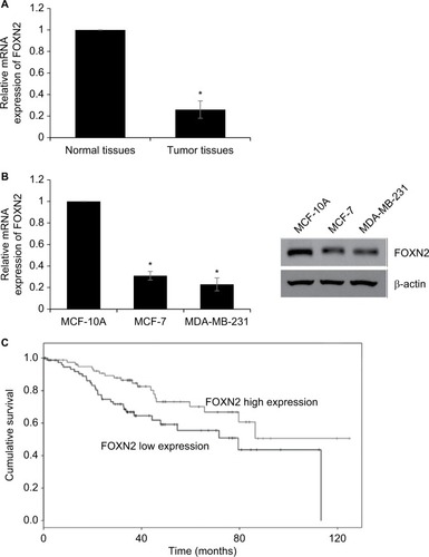 Figure 1 The relatively lower expression level of FOXN2 in breast cancer.Notes: (A) RT-qPCR assay revealed that FOXN2 expression levels were lower in breast cancer tissues compared with expression levels in adjacent healthy tissues. *P<0.05 vs adjacent normal tissues. (B) RT-qPCR and Western blotting results indicated that breast cells, including MCF-7 and MDA-MB-231, expressed lower levels of FOXN2 than MCF-10A cell. *P<0.05 vs MCF-10A. (C) Kaplan–Meier analysis followed by log-rank analysis demonstrated that the low expression of FOXN2 was associated with poor prognosis.Abbreviations: FOXN2, forkhead box N2; RT-qPCR, quantitative reverse transcription PCR.