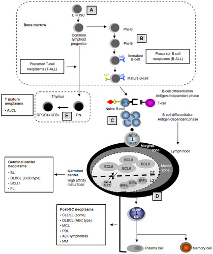 Figure 2 MYC roles in lymphoid differentiation and in lymphoid neoplasms.