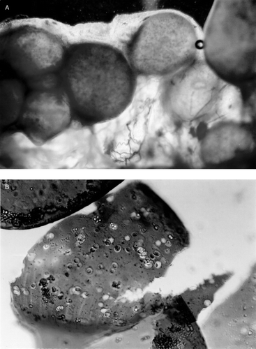Figure 3. (a) Recovered microcapsules at week 4 in Group I, these hepatocytes microcapsules were made by single-step encapsulation method. The microcapsules were attached to the greater omentum and connective tissue. (b) The recovered microcapsules in Figure 3a were mechanically destroyed and stained by trypan blue. The capsular membrane was infiltrated with lymphocytes and macrophages.