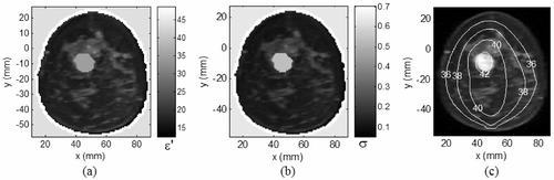 Figure 10. Hyperthermia simulation for model III with 60% decrease in εtumor. (a) Dielectric constant; (b) electrical conductivity at 500 MHz using Equation 10 and Citation[10], Citation[24]; (c) steady state thermal contours.