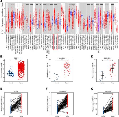 Figure 1 Expression levels of SLFN11 in pan-cancer and ccRCC tissues from the TCGA and GEO databases. (A) Pan-cancer analysis of SLFN11. (B–G) Data from TCGA, GSE53000, GSE105261, GSE40435, and GSE53757 showed that SLFN11 was highly expressed in ccRCC samples. *p < 0.05, **p < 0.01, ***, p < 0.001.