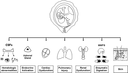 Figure 3. Fetal target organs during the fetal inflammatory response syndrome (FIRS): haematopoietic system, adrenals, heart, brain, lungs and skin. CSFs: colony stimulating factors; MMPs: matrix metalloproteinases. Reproduced with permission from reference 269.