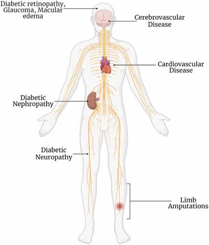 Figure 1. Diabetes-associated complications.