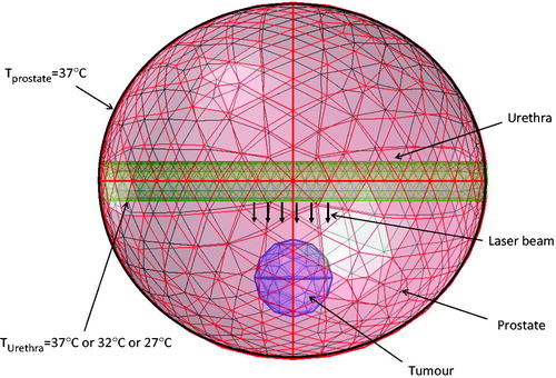 Figure 5. Meshed finite element prostate model with corresponding boundary conditions.