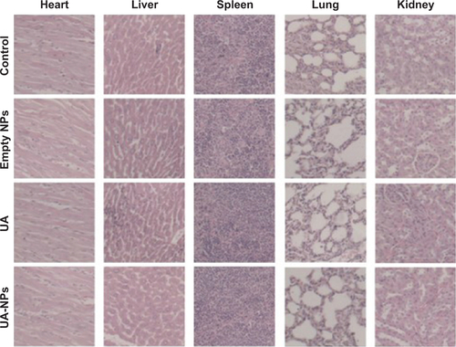 Figure S3 H&E staining of different tissues in mice from different groups of mice.Abbreviations: NP, nanoparticle; UA, ursolic acid; UA-NPs, UA-loaded poly(N-vinylpyrrolidone)-block-poly (ε-caprolactone) nanoparticles; H&E, hematoxylin and eosin.