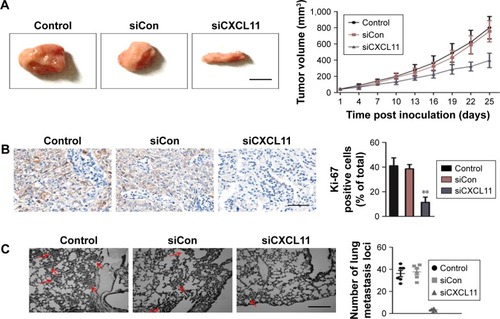 Figure 5 Down-expression of CXCL11 inhibits SW480 cell growth and metastasis in vivo.