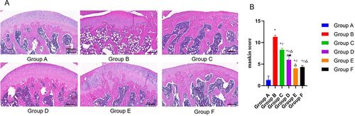 Figure 1 (A) Observation results of knee cartilage of rats in each group under light microscope. Scale, 100µm. (B) Mankin score of chondrocytes in each group. Notes: Group A, the blank group; Group B, the model control group; Group C, the CGG low-dose group; Group D, the CGG medium-dose group; Group E, the CGG high-dose group; Group F, the glucosamine hydrochloride group. CGG, Chonggu Granules. * Compared with group A, P < 0.05; # Compared with group B, P < 0.05; Δ Compared with group C, P < 0.05; ☆ Compared with group E, P < 0.05; ★ Compared with F group, P < 0.05.