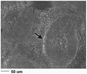 Figure 2. Fluorescence microscopy of RL platelets in slenic sinus.
