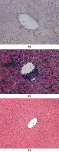 Figure 5. Hematoxylin—eosin stained liver section: normal control mice (A) with normal hepatic architecture around the central vein (CV), 200×; mice treated with Cd(II) acetate (B) with severe leukocyte infiltrations (arrow) in the central vein and distortion of the normal radiating pattern of the hepatocytes, 100×; and Cd-intoxicated animals subjected to therapy with monensin (C), 100×.