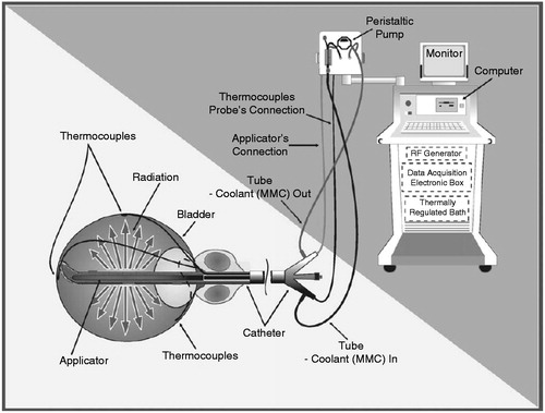 Figure 1. Schematic illustration of the Synergo® SB-TS 101 system during treatment.