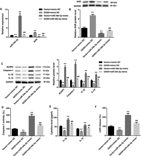 Figure 5. GAS5 overexpression inhibits NLRP3 inflammasome activation-mediated pyroptosis by inhibiting miR-34b-3p expression