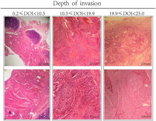 Figure 1. Representative immunohistochemical images of three different infiltration depths