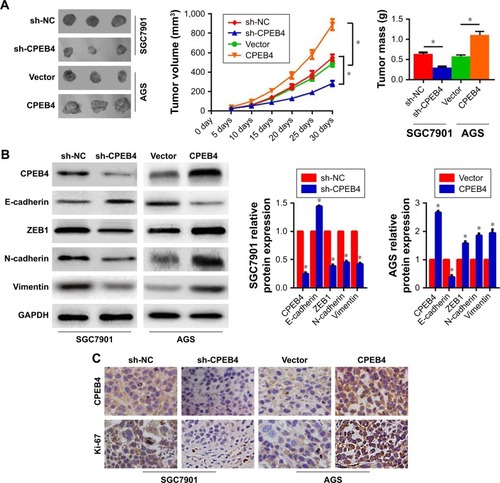Figure 5 Influences of CPEB4 silencing or overexpression on GC cells’ tumor growth in vivo.
