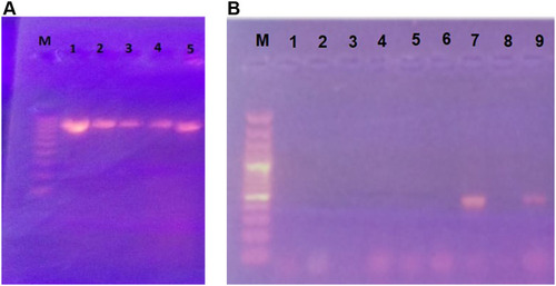 Figure 3 (A and B) Detection of UPEC PAIs using multiplex PCR B to detect 5 PAIs; PAI IJ96 (400 bp), PAI ICFT073 (930 bp), PAI II536 (1000 bp), PAI I536 (1800 bp) and PAI IIJ96 (2300 bp). (A); Lane M: 100 pb DNA ladder. Lanes 1–5: UPEC strains with PAI ICFT073. (B); Lane M: 100 pb DNA ladder. Lanes 1–6,8: UPEC strains with no PAI and Lanes 7,9 UPEC strains with PAI IJ96.