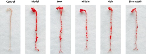 Figure 9. Oil Red O staining of aortic vessels of male Apoe deficient (Apoe-/-) mice in different groups and wild-type (control) C57BL/6J mice. Treatment was initiated at 17 weeks of age and continued for another 8 weeks with intragastrical administration. Low-dose, Middle (Moderate)-dose and High-dose groups were, respectively, given a dose of 4.51 g/kg/d, 9.01 g/kg/d and 18.02 g/kg/d of herbal decoction of N. nucifera leaves, while the control and model group were given 0.9% normal saline. The Simvastatin group was given 3.00 mg/kg/d of Simvastatin solution as a positive control. The red areas represent the atherosclerotic plaques of aortic vessels of mice in different groups.