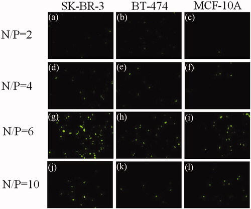Figure 6. Results of N/P ratio optimization. Polyplexes were prepared by mixing pEGFPN1 plasmid and PEI polymers at various N/P ratios of 2, 4, 6 and 10. Transfection efficiency was determined 48h post transfection using fluorescence microscopy imaging. The micrographs (a), (b) and (c) show the cells which transfected with N/P ratio of 2; (d), (e) and (f) show the cells which were transfected with N/P ratio of 4; micrographs (g), (h), and (i) show the cells which were transfected with N/P ratio of 6 and (j), (k) and (l) show the cells which were transfected with N/P ratio of 10.