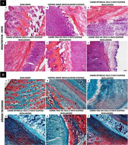 Figure 5. Histopathological analysis of decellularized and recellularized tracheal scaffolds (EpC/YS) implanted in the subcutaneous tissue of balb-C nude mice. I. H&E staining. In (a) Skin fragment: intact keratinized stratified squamous epithelium (eq), loose organized connective tissue (cf), sweat glands attached to the hair follicle (g), dense unmodeled connective tissue (td) and muscle tissue (tm). In (b-e) Deep dermis: area with the presence of implanted tracheal tissue (t), hyaline cartilage tissue, showing nucleated chondrocytes and formation of isogeny groups (gi) associated with ECM. Adjacent to this tissue, it is possible to observe a dense unmodeled connective tissue (td) associated with a discrete inflammatory infiltrate (i). Discrete presence of collagen fiber deposition surrounding the implanted tissue (c). In (f) Epidermis: intact keratinized stratified squamous epithelium (eq), dense unmodeled connective tissue (td). Deep dermis with an area showing a fragment of implanted tracheal tissue [hyaline cartilage] (t), chondrocytes and discrete formation of isogenous groups (gi). Adjacent to this tissue, it is possible to observe a dense unmodeled connective tissue (td) associated with a discrete mononuclear inflammatory infiltrate (i). Scale bar: (a-b; d-f: 100 µm, 10x/C: 500 µm, 20x). II. Gömori Trichrome stain. In (b) Area with the presence of implanted tracheal tissue (t), hyaline cartilage tissue, showing nucleated chondrocytes and formation of isogenous groups (gi) trapped by an extracellular matrix. Adjacent to this tissue it is possible to observe a dense unmodeled connective tissue (td). Discrete presence of collagen fiber deposition surrounding the implanted tissue (c). In (C) Deep dermis: area with the presence of implanted tracheal tissue (t) and region with mild edema (e). Adjacent to this tissue it is possible to observe a dense unmodeled connective tissue (td). Moderate presence of collagen fiber deposition surrounding the implanted tissue (c) and lymphoplasmacytic inflammatory infiltrate (i). In (DF) Area with presence of implanted tracheal tissue (t), hyaline cartilage tissue, presence of chondrocytes, highlighting the chondrocyte nucleus, emphasizing successful recellularization (arrow), in (e) discrete edema area (and) and in (f) presence of chondrocytes with visible nuclei and formation of isogeny groups (gi). Adjacent to this tissue, it is possible to observe a dense unmodeled connective tissue (td), deposition of collagen fibers surrounding the implanted tissue (c). Scale bar: (a- f: 100 µm, 10x).