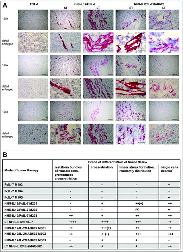 Figure 6. In vivo expression and organization of desmin as a marker of myogenic differentiation in A204 RMS. (A) Histologic slides from tumors (n = 3/cohort) of all cohorts (FcIL-7, NHS-IL12/FcIL-7, or NHS-IL12/IL-2MAB602 treated) were stained for desmin (scale bars: 200 µm) and analyzed by a pathologist (B) in a blinded manner. LT: long-term treatment; ST: short-term treatment.