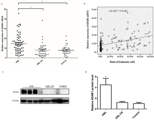 Figure 1 Expressions of ADAR1 in AML patients and the control subjects. (A) The mRNA levels of ADAR1 in AML patients and control subjects were measured by qPCR . (B) The relationship between the levels of ADAR1 mRNA and the ratio of leukemic cells. (C) Representative pictures of three independent experiments that gave similar results were shown. (D) Summarized data of Western blots of the levels of ADAR1 protein in AML patient and control group. Data were shown as mean ± S.E.M. *P<0.05. **r=0.432, P<0.001 Spearman correlation analysis.