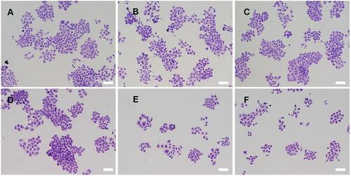 Figure S9. The colony formation assay of HepG2 cells transfected with different nanoparticles: (A) control, (B) Dz13, (C) PP, (D) PP/Dz13Scr, (E) PP/Dz13 and (F) PAMAM/Dz13 nanoparticles. The scale bar is 100 μm.