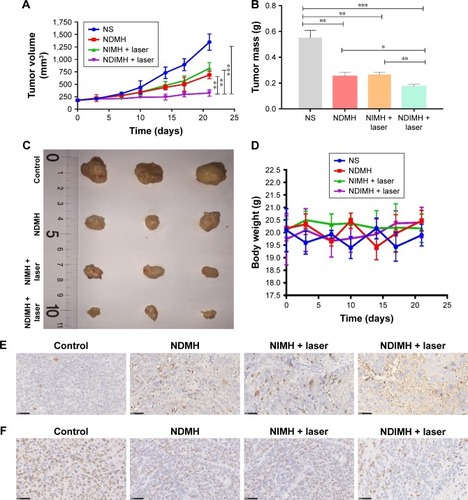 Figure 5 Antitumor effects and biosafety evaluation of NDIMH in vivo.Notes: (A) SCC-15 tumor growth curves of different groups after intratumoral injection up to 21 days (mean ± SD, n=3, **P<0.01, ***P<0.001). (B) SCC-15 tumor mass histogram of different groups 21 days after treatments (mean ± SD, n=3, *P<0.05, **P<0.01, ***P<0.001). (C) The photograph of excised tumors 21 days after treatments. (D) The body weight changes of the mice during treatments (mean ± SD, n=3). (E) TUNEL apoptosis assay of tumor sections 21 days after treatments. Cells stained brown indicated apoptotic cells (scale bar represents 50 µm, magnification ×40). (F) Immunohistochemical staining for Ki67 expression of tumor sections 21 days after treatments. Cells stained brown indicated proliferating cells (scale bar represents 50 µm, magnification ×40). (G) Histological sections of the main organs (brain, heart, liver, spleen, lungs, and kidneys) were stained by H&E.Abbreviations: NDIMH, nano doxorubicin-indocyanine green matrix metalloproteinase-responsive hydrogel; NDMH, nano doxorubicin matrix metalloproteinase-responsive hydrogel; NIMH, nano indocyanine green matrix metalloproteinase-responsive hydrogel; NS, normal saline.