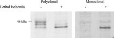 Figure 5 Immunoblots of rat myofibroblasts exposed to 4 h of lethal ischemia (lane 2 and 4) or no exposure (lane 1 and 3) and probed with polyclonal anti-Cx43 antibodies (detecting all isoforms of Cx43), and monoclonal anti-Cx43 antibodies (detecting a site-specific nonphosphorylated isoform of Cx43).