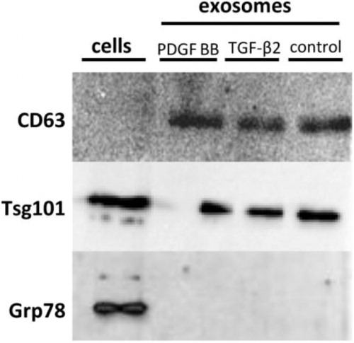 Fig. 1 Western blots results. CD63 is present in all 3 of the exosome samples but not in the cell suspension, while Tsg101 is enriched in both the exosome samples and the cell suspension. Grp78 is only found in the cell suspension, indicating no detectable contamination of apoptotic bodies. These results demonstrate the authenticity of the exosome samples.