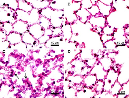 Figure 3 H&E examination under light microscopy (original magnification: ×100).