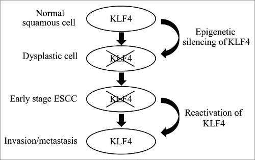 Figure 5. A model for the role of KLF4 during esophageal squamous cell carcinogenesis. KLF4 is silenced, typically by hypermethylation, permitting normal esophageal squamous epithelial cells to become dysplastic and transform into ESCC. In ESCC cells, which are now transformed, reactivation of KLF4 enhances invasion and metastasis.