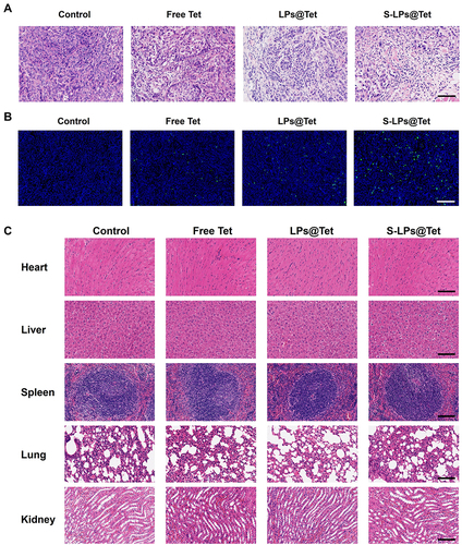 Figure 11 H&E (A) and TUNEL (B) staining results of tumor tissue. (C) H&E results of major organ. (Scale bar, 100 μm).