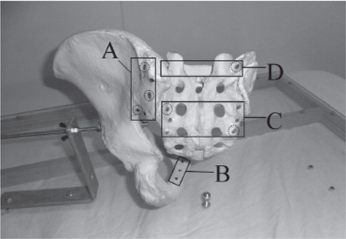 Figure 19. The RSA markers were divided into different marker segments (MS): MS A = five dorsal markers in the ilium; MS B = three frontal markers in the inferior pubic ramus; MS C = six sacral markers; and MS D = two cranial markers in the sacrum. Circles = three randomly selected markers in the ilium and three randomly selected markers in the sacrum.