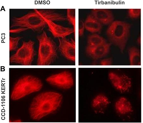 Figure 2 Disruption of microtubule architecture in PC3 and CCD-1106 KERTr cells by tirbanibulin (ATNXUS-KX01-001 study): representative figures of tubulin disruption in (A) PC3 and (B) CCD-1106 KERTr cells treated with tirbanibulin (100 and 200 nM, respectively) or control DMSO for 2 hours. Cells were then fixed, permeabilized, and stained with an antibody to tubulin. DMSO=dimethyl sulfoxide.