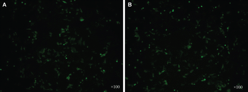 Figure 4.  Result of inverted fluorescence microscope (×100). A: Plasmid purified using OMEGA kit B: Plasmid purified by 3 M ammonium sulfate.