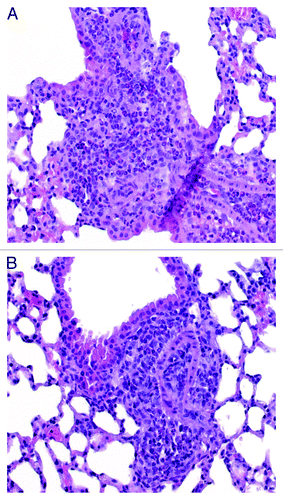 Figure 6. Representative hematoxylin and eosin stained lung sections of WBP challenged mice only sensitized toward Bet v 1 protein (A) or sensitized and then treated with ST[rBet v 1]. (B) Mature eosinophils are visible as small cells with donut-shaped blue nucleus of compact chromatin surrounding the pink cytoplasm (original magnification 40×). WBP: White Birch Pollen extract.