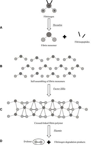 Figure 1 The process of D-dimer generation: 1) Thrombin cleaves fibrinopeptides from fibrinogen monomer (A); 2) Fibrin monomers aggregate (B); 3) Fibrin monomers are cross-linked by factor XIIIa, that stabilizes the fibrin polymer (C); 4) fibrin is degraded by plasmin, releasing D-dimer and fibrinogen degradation products (FDP) (D).