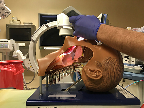 Figure 2 Insertion of Vie Scope® and laryngoscopy.