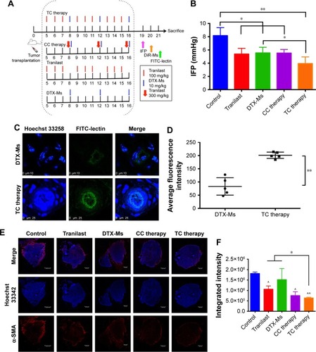 Figure 5 Effect of treatments on tumor microenvironment.Notes: (A) Treatment scenarios on tumor bearing mice. (B) IFP of 4T1 tumor bearing mice after treatments (n=3). (C) FITC-lectin perfusion in tumor. Scale bar: 10 µm (up); 25 µm (down). (D) Fluorescence intensity analysis (n=5). (E) CAFs marker α-SMA protein expression in tumor (scale bar: 1.00 mm). Red fluorescence indicated α-SMA protein and blue fluorescence indicated cell nucleus. (F) Fluorescence intensity analysis from sections of two mice. ^ and ^^ means significance to control. * means significance between tranilast (or DTX-Ms) and TC therapy. **P<0.01. *P<0.05.Abbreviations: IFP, interstitial fluid pressure; CAFs, cancer-associated fibroblasts; α-SMA, α-smooth muscle actin; TC therapy, two-stage combination therapy; CC therapy, co-dose combination therapy; DTX-Ms, docetaxel micelles; DiR-Ms, 1,1′-dioctadecyl-3,3,3′,3′-tetramethylindotricarbocyanine iodide-loaded micelles.