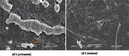 Figure 4 Scanning electron microscopy (SEM) images showing untreated and levofloxacin treated 18 hours E. coli biofilm cells. Concentrations of levofloxacin was 50 μg/mL. Magnification: ×5000.Notes: a, Individual E. coli cells; b, exopolysaccharide.