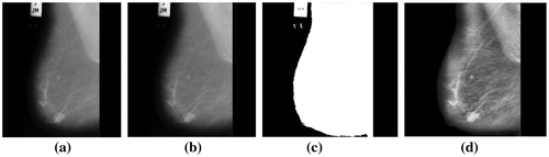 Figure 1. (a) Mammogram image mdb005. (b) Image obtained after noise filtering (c) Binary masks obtained after global thresholding and (d) Final enhanced image with artefacts and labels removed.