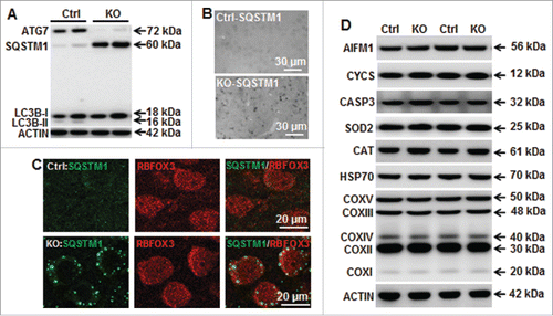 Figure 2. Neuronal Atg7 deficiency prevents neuronal basal autophagy and does not alter expression of mitochondria and cell death-related proteins. (A) Representative immunoblotting of ATG7, SQSTM1, and LC3BB in the atg7 KO (Atg7flox/flox; Nes-Cre) and Ctrl (Atg7flox/+; Nes-Cre) mice showing that ATG7 was strongly decreased in KO mice leading to an accumulation of SQSTM1 and absence of LC3BB-II. (B) Representative immunostaining of SQSTM1 in the cortex of Ctrl and atg7 KO mice in the non-HI control condition, confirming the accumulation of SQSTM1 in KO compared to the faint and diffuse expression in Ctrl. (C) Punctate and strong SQSTM1 staining was observed in the cytoplasm of neuronal cells (RBFOX3) in the cortex of atg7 KO mice, but not in the Ctrl as shown by RBFOX3 and SQSTM1. (D) Representative immunoblots from cortical tissue homogenates of P9 Ctrl and atg7 KO mice. Quantification did not show any significant differences between the 2 types of mice for cell death-related proteins AIFM1, CYCS and CASP3, mitochondria-related proteins (SOD2, HSP70, CAT and mitochondrial respiratory chain complexes (COXV, COXIII, COXIV, COXII, COXI). (n = 6/group). KO: atg7 KO (Atg7flox/flox; Nes-Cre) and Ctrl: Atg7flox/+; Nes-Cre.