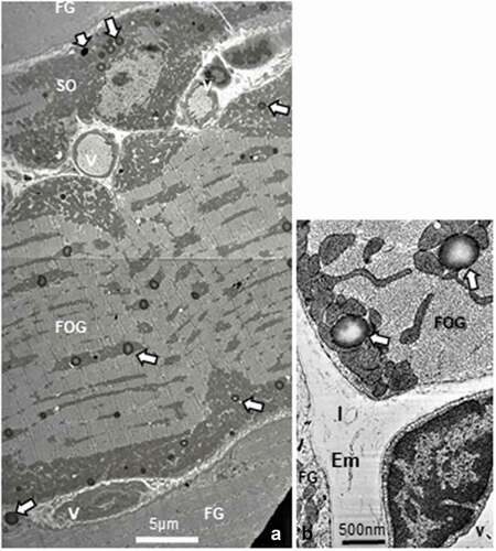 Figure 3. a-b: Pane of TEM aspects of 45-week-old obese female fa/fa tibialis anterior muscle showing parts of adjacent 3 main fiber types. Both SO and FOG fiber profiles typically contained mitochondria aggregates in the subsarcolemmal perikaryal and intermyofibrillar zones with large spherical lipid deposits (white arrows). FG fibers displayed only rare droplets (low left bottom arrow). b: Enlarged view of peripheral zone of an FOG fiber with spherical lipid depots (white arrows), adjacent to mitochondria. Em: Endomysium; FG: fast glycolytic fiber; v: blood vessel, l: lymphatic capillary