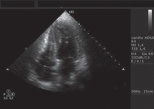 Figure 3. Left ventricular systole after recovery.