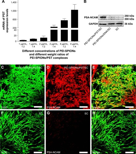 Figure 5 Expression and translation analyses of transferred exogenous PST.Notes: (A) At 72 h after magnetofection, mRNA levels of PST in each group (already normalized by normal control SCs). (B) At 72 h after incubation/magnetofection, detection of PSA-NCAM expression in SCs, PEI-SPIONs/DNA/SCs, and PEI-SPIONs/PST/SCs by Western blotting. An obvious PSA-NCAM-specific band was detected in PEI-SPIONs/PST/SCs, while no PSA-NCAM-specific band was found in SCs and PEI-SPIONs/DNA/SCs. (C–E) At 72 h after magnetofection, confocal images showed the abundant expression of PSA-NCAM (red) in S100-labeled PEI-SPIONs/PST/SCs (green). (F–H) No PSA-NCAM (red) was detected in S100-labeled SCs (green). Scale bar: (C–H) 100 μm. Graph bars: mean ± SD.Abbreviations: mRNA, messenger RNA; PEI-SPIONs, polyethylenimine-coated superparamagnetic iron oxide nanoparticles; PSA-NCAM, polysialylated neural cell adhesion molecule; PST, polysialyltransferase; SCs, Schwann cells; SD, standard deviation.